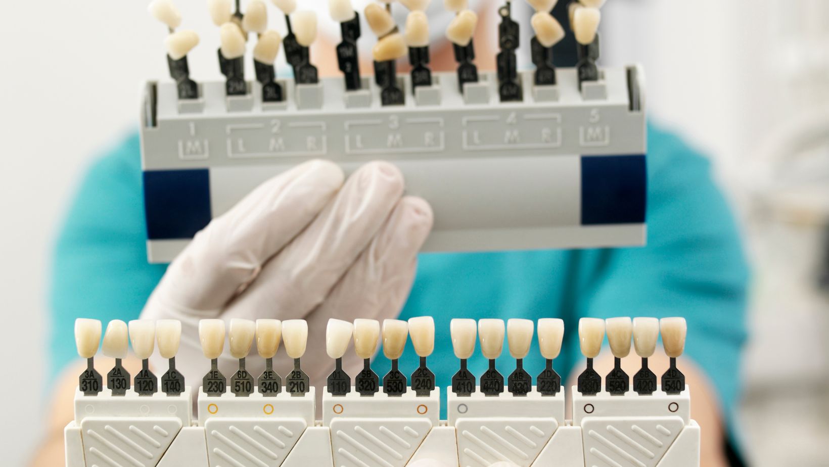 Dental Veneers: How Do They Work?